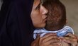 A woman in a dark veil holds a skinny little boy. Photo: WFP/Ali Jadallah