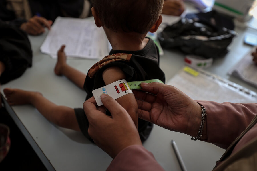 A small child sits on a table getting tested for malnutrition - the testing strip shows red, indicating severe-acute malnutrition. Photo: WFP/Ali Jadallah