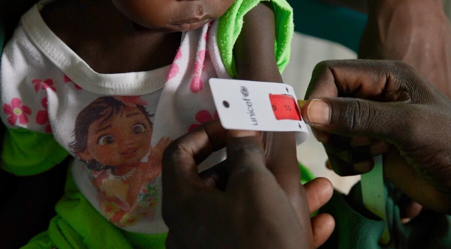 A close up of a band testing for malnutrition around a small child and showing red - the sign for severe acute malnutrition. Photo: WFP/Gabriela Vivacqua